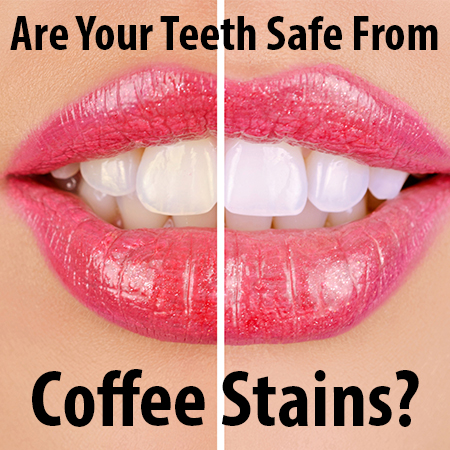 You don’t have to put up with discoloration and coffee stained teeth. Dr. Twiss at Twiss Dental, tells you about teeth whitening in Highlands Ranch.
