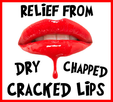 Highlands Ranch dentists, Dr. Twiss at Twiss Dental, tell you how to relieve your dry, chapped, and cracked lips!