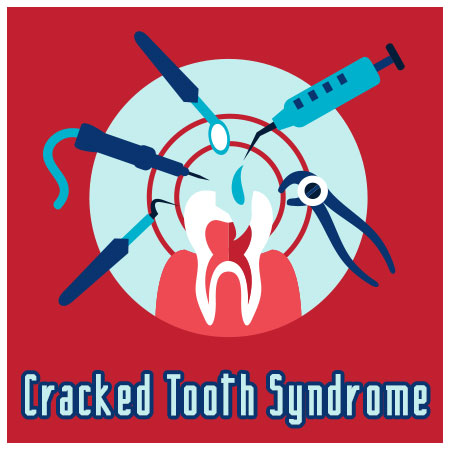 Highlands Ranch dentists, Drs. Twiss, Baller, & Robinson at Twiss Dental, discuss causes, symptoms, and treatment of cracked tooth syndrome.