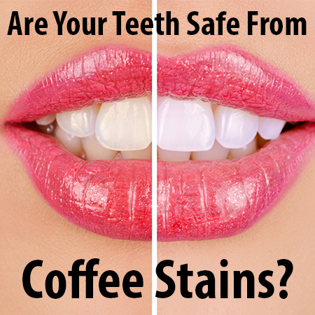 You don’t have to put up with discoloration and coffee stained teeth. Dr. Twiss at Twiss Dental, tells you about teeth whitening in Highlands Ranch.