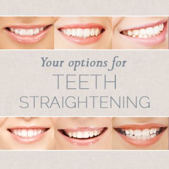 Highlands Ranch dentist, Dr. Twiss at Twiss Dental shares all you need to know about choosing the right teeth straightening option for you.