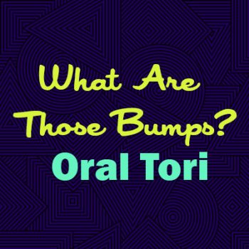 Highlands Ranch dentist, Dr. Tyler Twiss at Twiss Dental explains oral tori—what they are, why they happen, and whether they are a cause for concern.