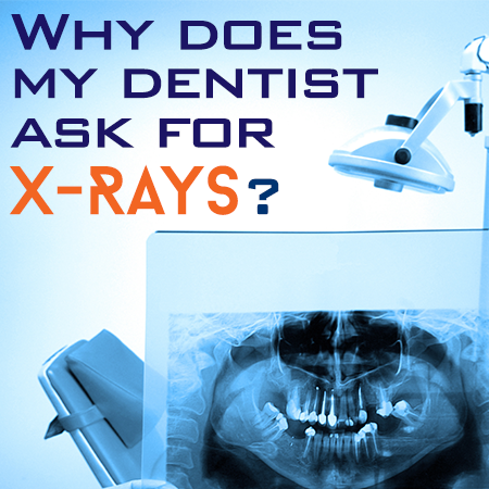 Highlands Ranch dentists, Dr. Twiss at Twiss Dental, discusses the importance of dental x-rays for accurate diagnosis and treatment planning.